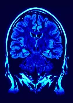 Non-invasive in vivo imaging 