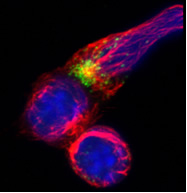 Basic cell and molecular biology (including structural and cell biology), immunity and infection
