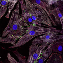 Medical Research at the Cambridge Institute for Medical Research (CIMR)