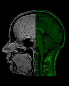 UCL Brain Image